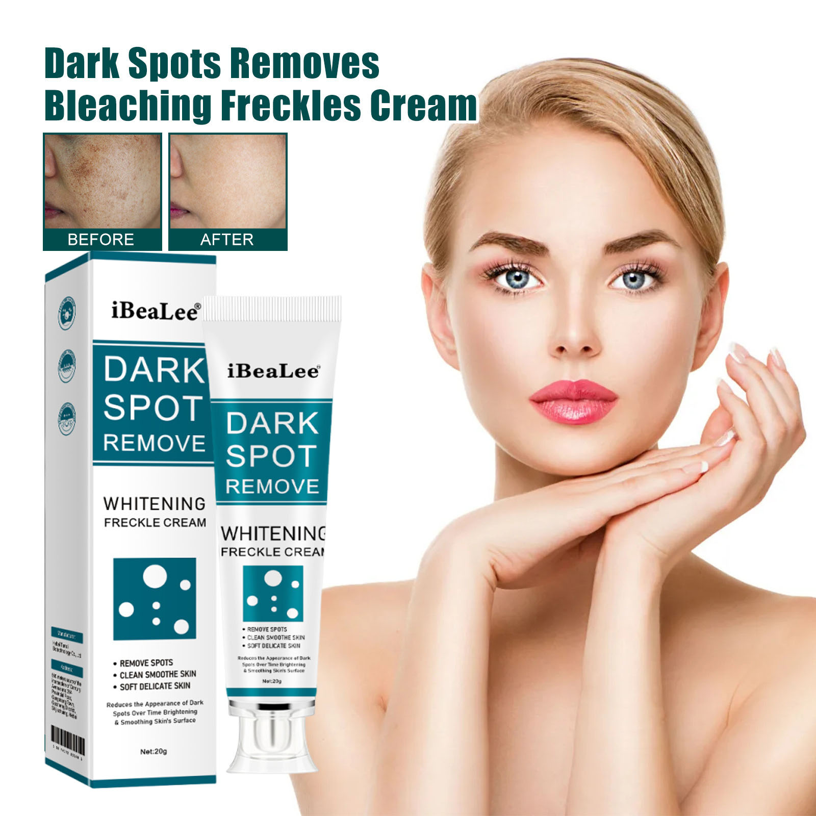 Skincare Glad2Glow - Melasma Aufhellende Gesichtscreme Niacinamid-Serum Aufhellungscreme Reduziert
